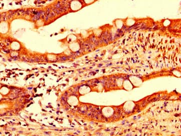 Polyclonal Rabbit anti-Human IL17F Antibody (IHC)