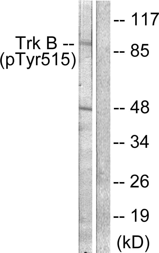 NTRK2 / TRKB Antibody (phospho-Tyr515)