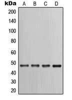 IHC-plus™ KRT17 / CK17 / Cytokeratin 17 Antibody (C-Terminus)