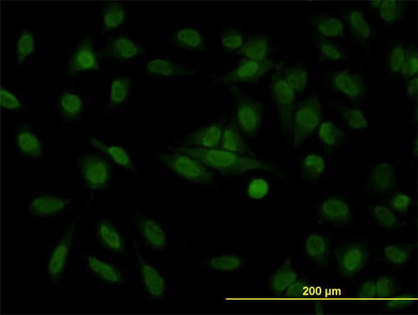 IHC-plus™ Monoclonal Mouse anti-Human STAG1 / SA1 Antibody (clone 2E9, IHC, IF, WB)