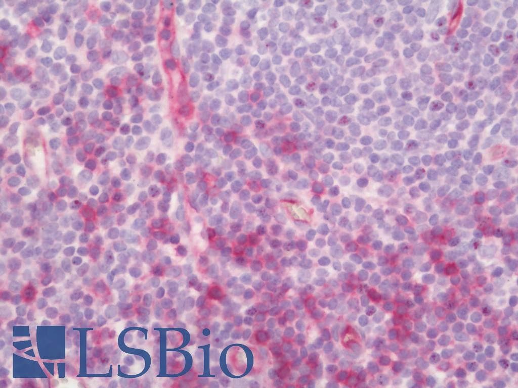 IHC-plus™ Polyclonal Rabbit anti-Human EGFR Antibody (aa651-700, IHC, WB)
