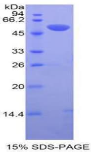 Human PLAT / TPA Protein (Recombinant His-GST)