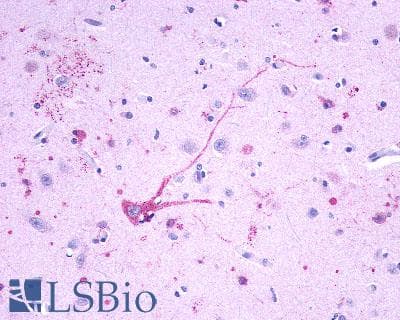 PathPlus™ Leukotriene B4 Receptor / BLT1 Antibody (Cytoplasmic Domain)