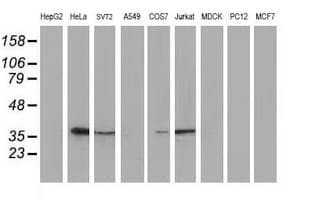 MAPRE2 / EB2 Antibody (clone OTI4G1)