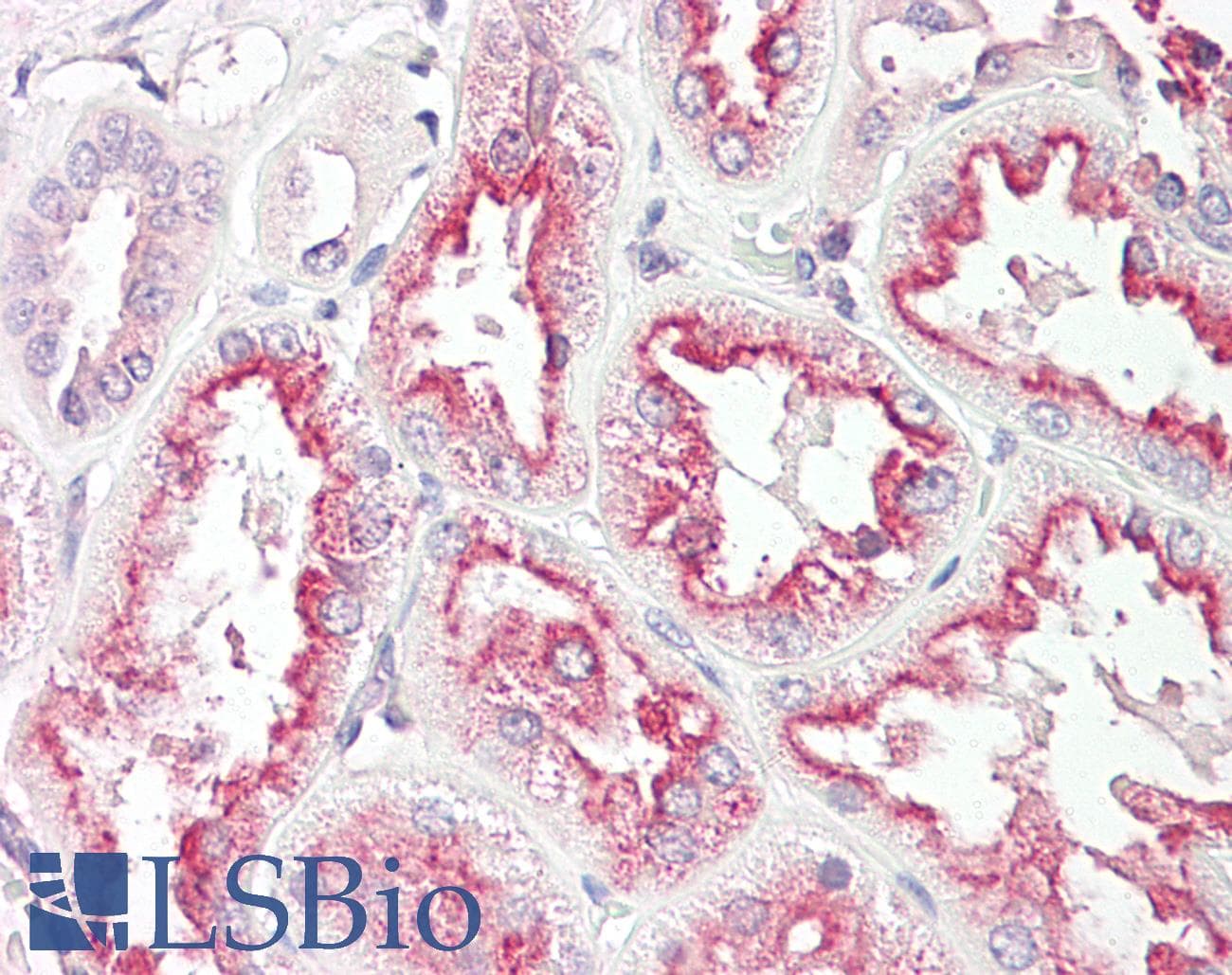 TNMD / Tenomodulin Antibody (aa74-123)