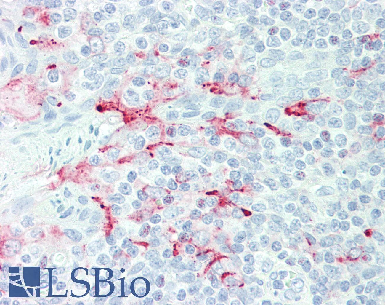 IHC-plus™ MSLN / Mesothelin Antibody (clone MN-1)