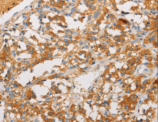 ART3 Antibody