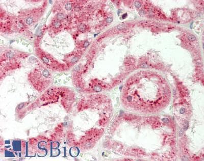 IHC-plus™ CTSS / Cathepsin S Antibody (aa210-240)