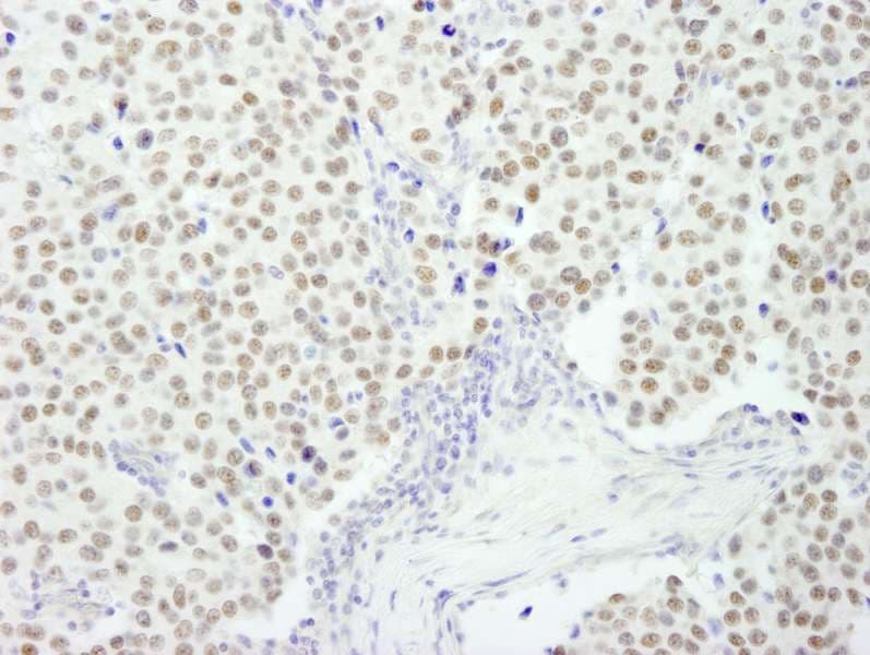 RCOR3 Antibody (aa445-495)