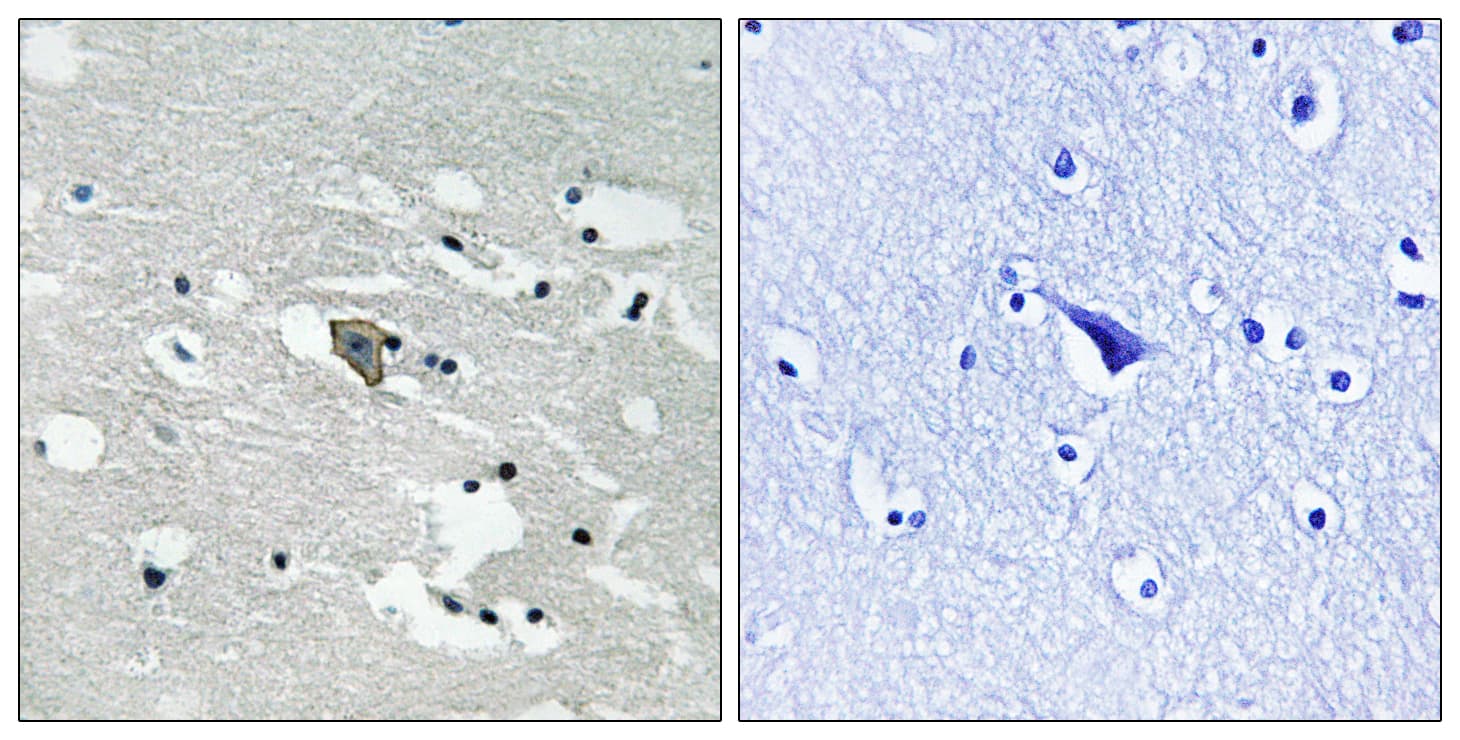 FLT1 / VEGFR1 Antibody (phospho-Tyr1048)