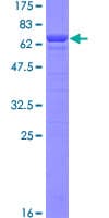 Human MDH1 Protein (Recombinant GST)