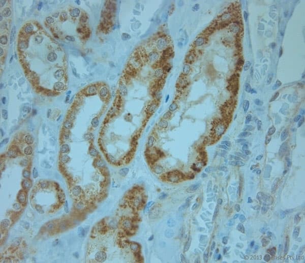 KCNJ13 / KIR7.1 Antibody (aa2-50)