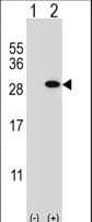 GSTT1 Antibody (aa7-34)