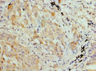 HIST1H3A Antibody