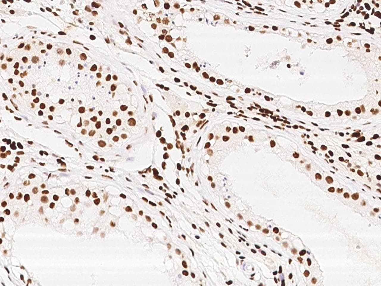 Polyclonal Rabbit anti-Human KLF7 Antibody (IHC)