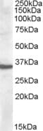 IHC-plus™ APOF / Apolipoprotein F Antibody (aa313-325)