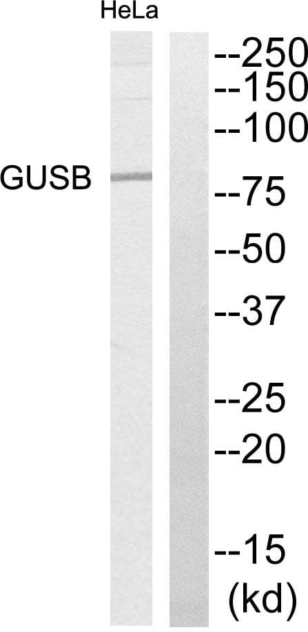 Polyclonal Rabbit anti-Human GUSB / Beta Glucuronidase Antibody (WB)