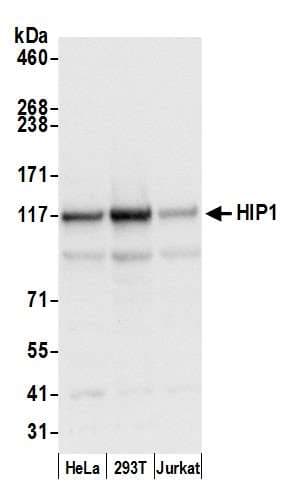 Polyclonal Rabbit anti-Human HIP1 Antibody (aa987-1037, WB)