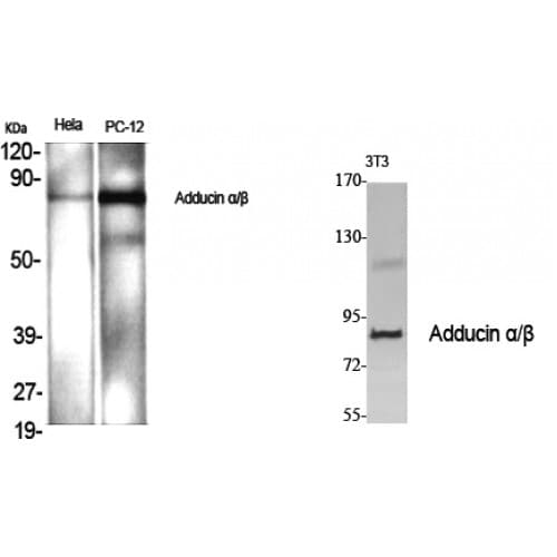ADD1 + ADD2 Antibody (670-750 aa)