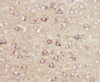 Beta Amyloid Antibody (aa672-702)