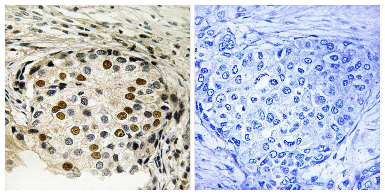 OXSR1 / OSR1 Antibody (phospho-Thr185)