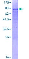 Human IDH2 Protein (Recombinant GST)