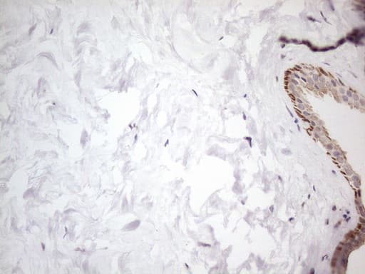 ATF1 Antibody (clone OTI7H3)