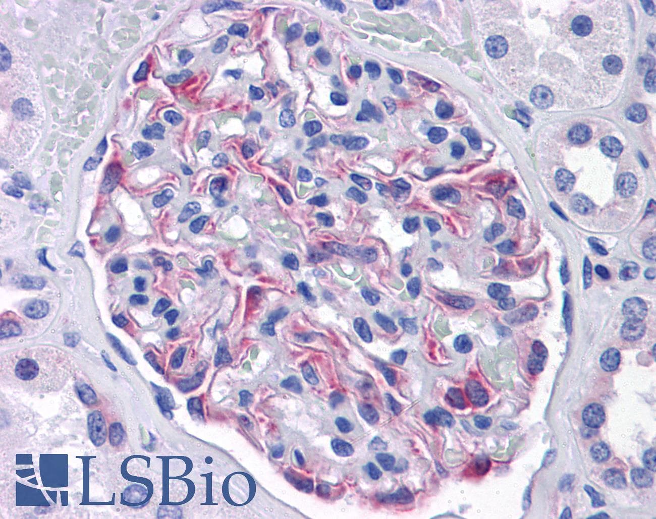 IHC-plus™ SLC44A2 / CTL2 Antibody (clone 3D11)