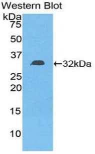 DGKE / DGK Epsilon Antibody (aa243-502, APC)