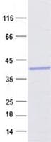 Human SIVA1 / SIVA Protein (Recombinant GST, N-terminus + His, C-terminus)
