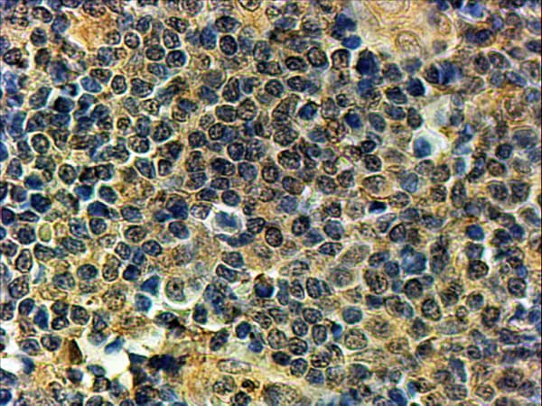 Polyclonal Goat anti-Human BLIMP1 / PRDM1 Antibody (aa778-789, IF)