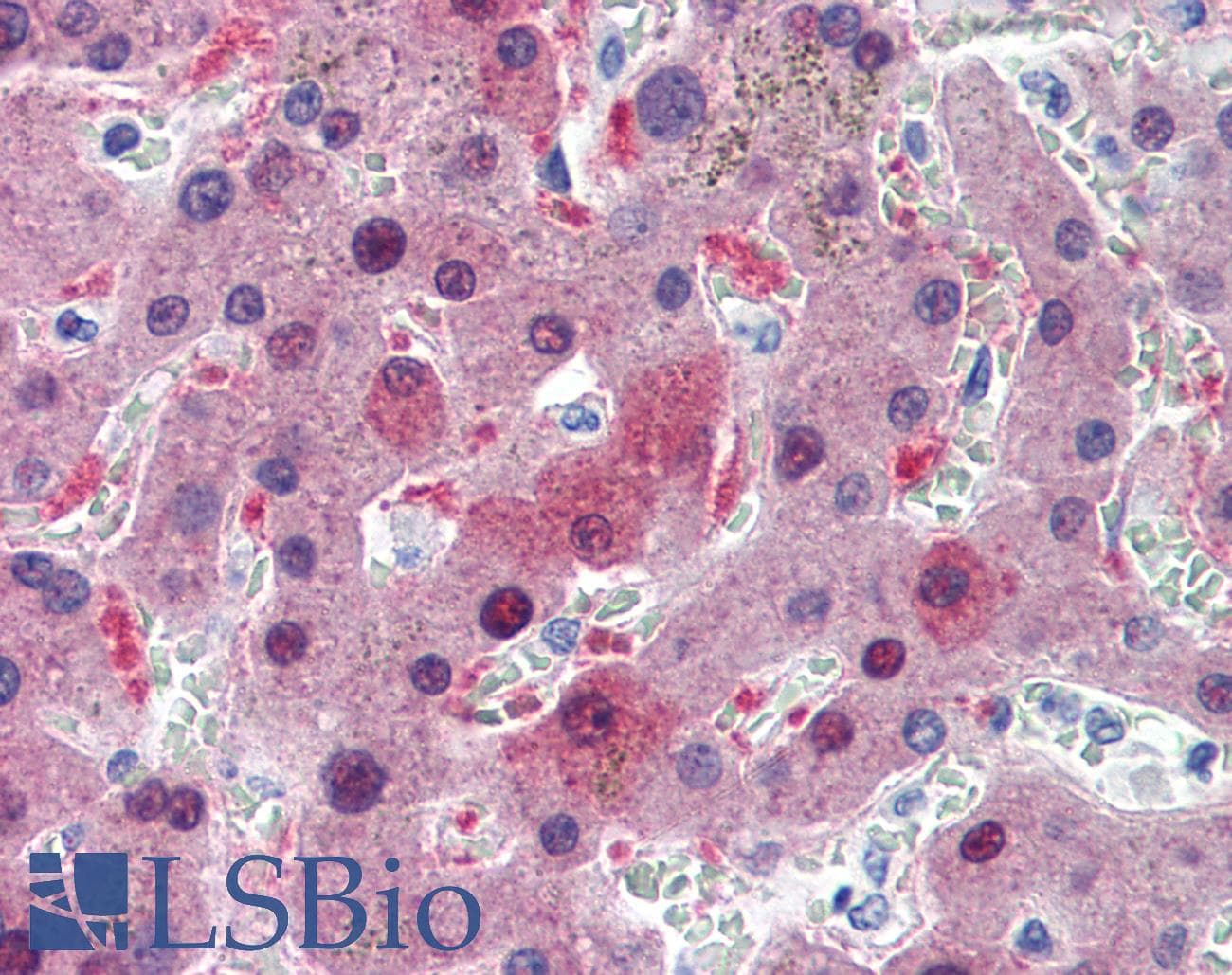 IHC-plus™ Monoclonal Mouse anti-Human GSTA1 Antibody (clone 2F7, IHC, WB)