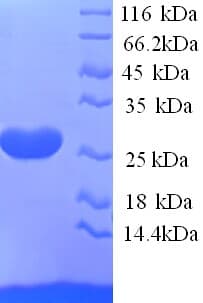 Rat EFNA5 / Ephrin A5 Protein (Recombinant His)