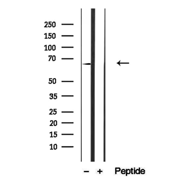 Polyclonal Rabbit anti-Human CRAT Antibody (IHC, IF, WB)