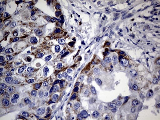 Monoclonal Mouse anti-Human FOXP3 Antibody (clone OTI3D1, IHC, WB)