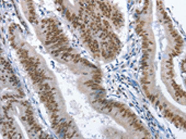 Polyclonal Rabbit anti-Human GNRH Antibody (IHC)