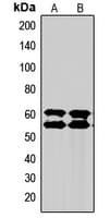 SMAD2+3 Antibody (N-Terminus)