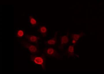CDKL4 Antibody
