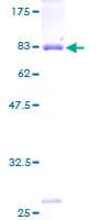 Human ANXA11 / Annexin XI Protein (Recombinant GST)