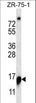 RPP25 Antibody (aa169-197)