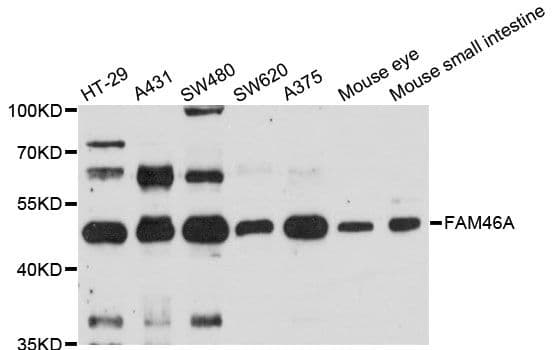 FAM46A Antibody