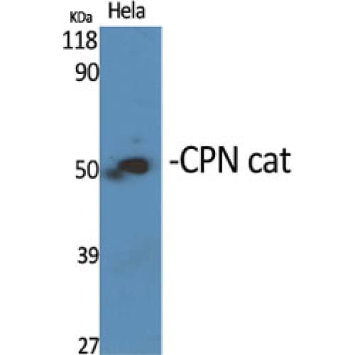 CPN1 Antibody (380-460 aa, C-terminal)