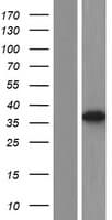 ANKRD16 Protein (Over-Expression Lysate Myc-DDK (Flag))