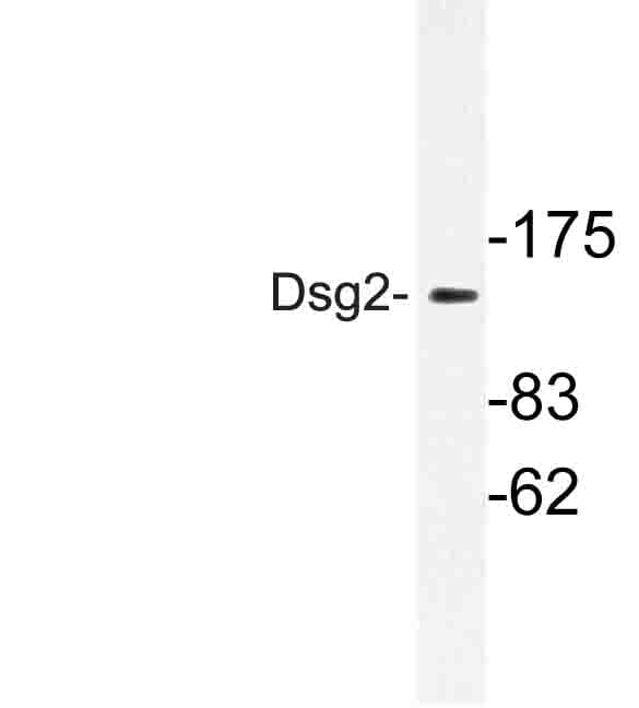 Polyclonal Rabbit anti-Human DSG2 / Desmoglein 2 Antibody (Val440, WB)