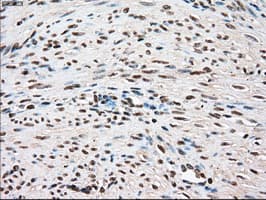 TYRO3 Antibody (clone OTI4C8)