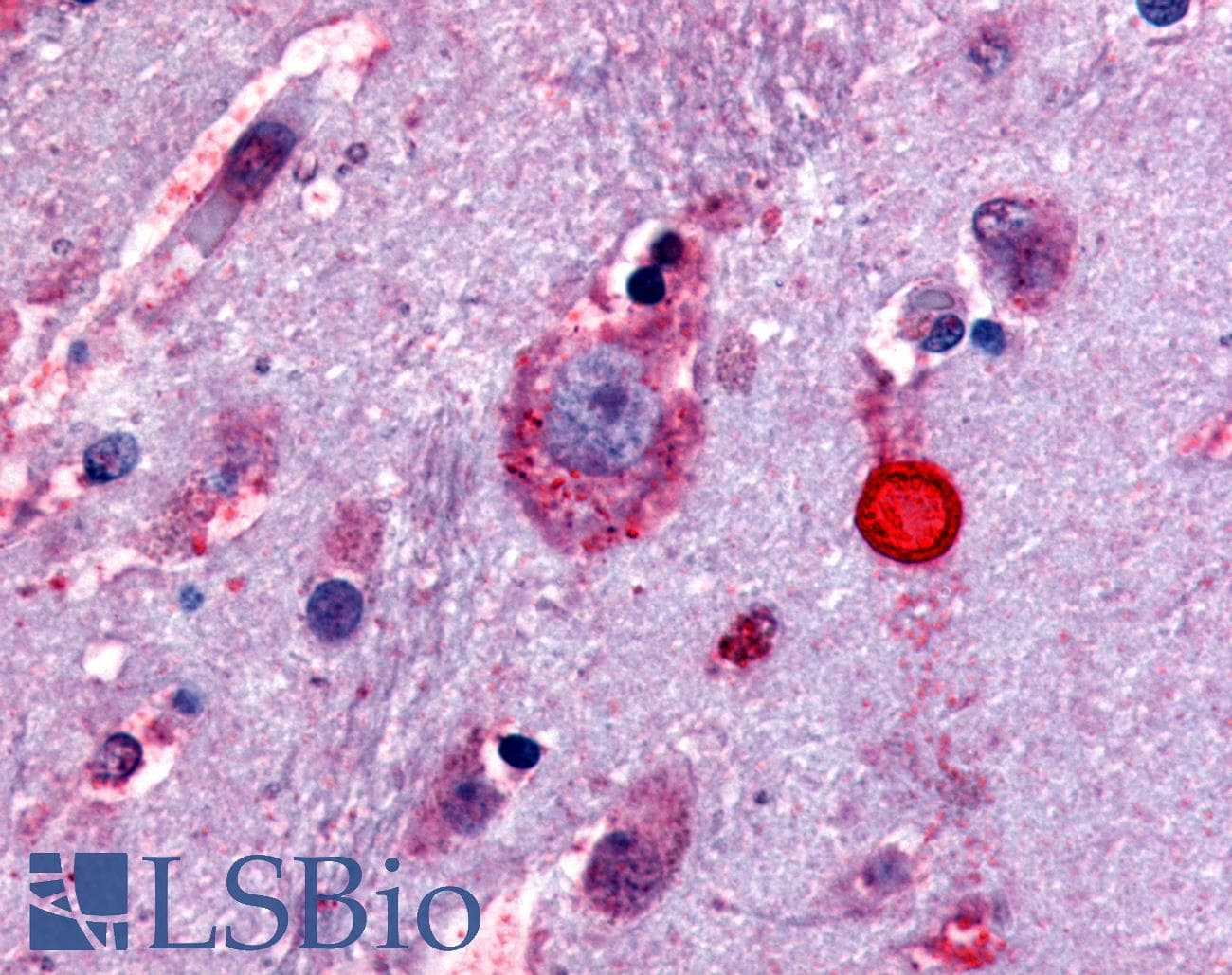 PathPlus™ OPRD1 / Delta Opioid Receptor Antibody (Extracellular Domain)