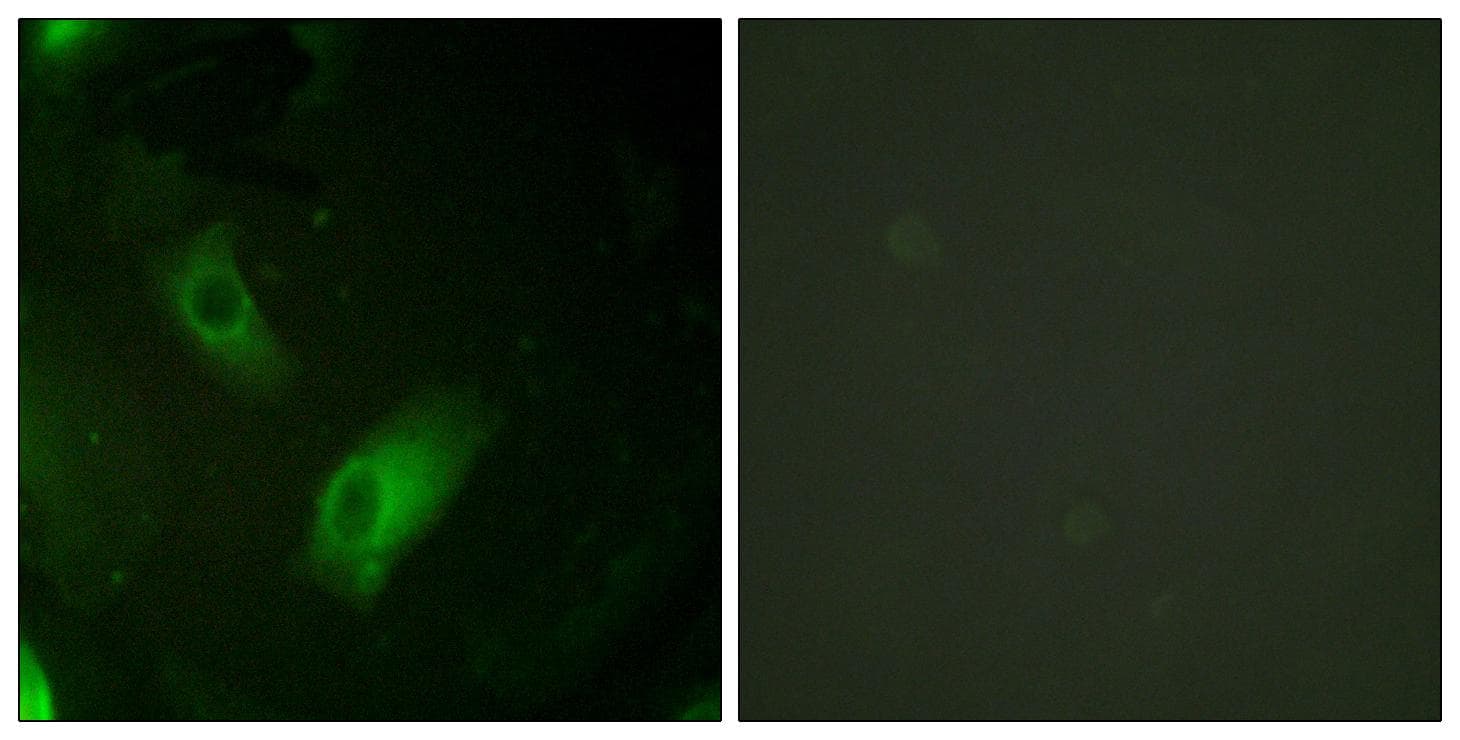 Polyclonal Rabbit anti-Human ACO1 / Aconitase Antibody (Ab-138, IHC, IF)