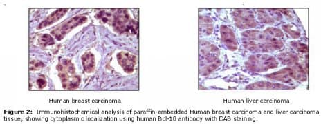 BCL10 / BCL-10 Antibody (clone 4F8E8H8)