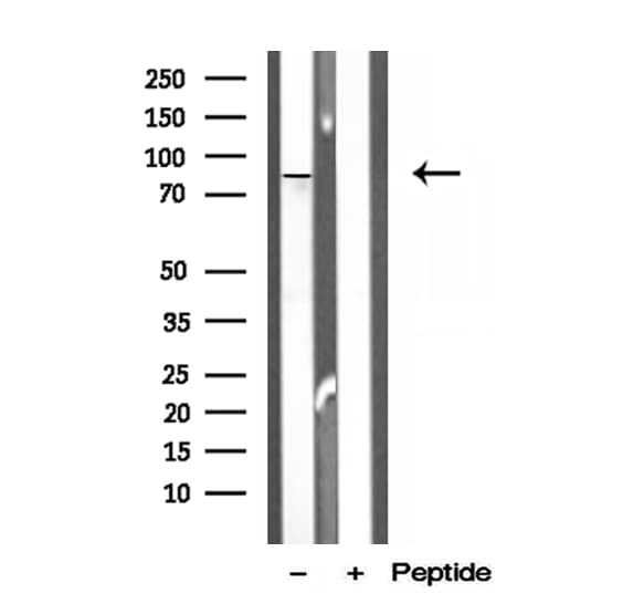 OSBP Antibody