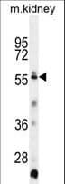 TRIML1 Antibody (aa376-404)